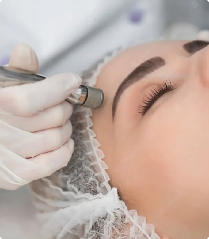 Dermabrasion treatment being performed on a woman's forehead for skin rejuvenation.