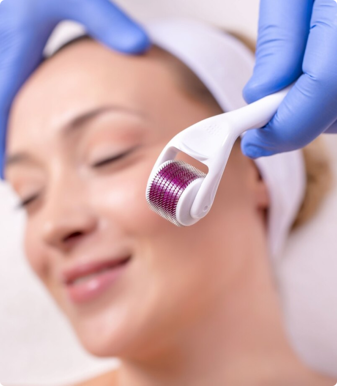 Dermaroller treatment being applied to a woman's face for skin rejuvenation.