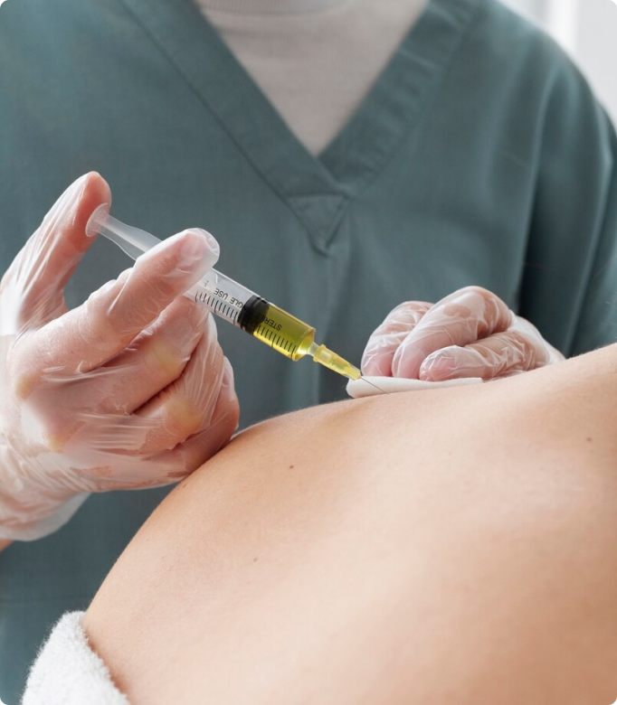 Fat injection into scar area for improved skin texture and healing.
