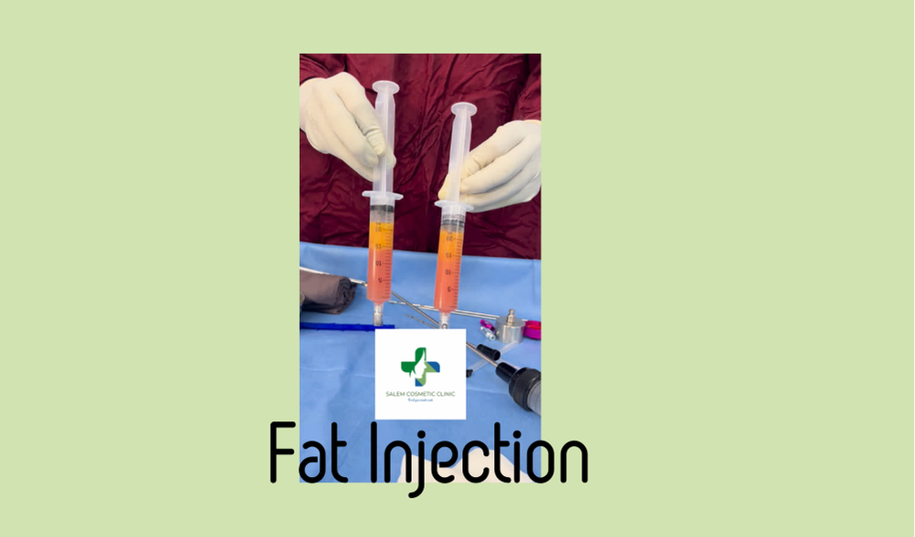 Fat injection