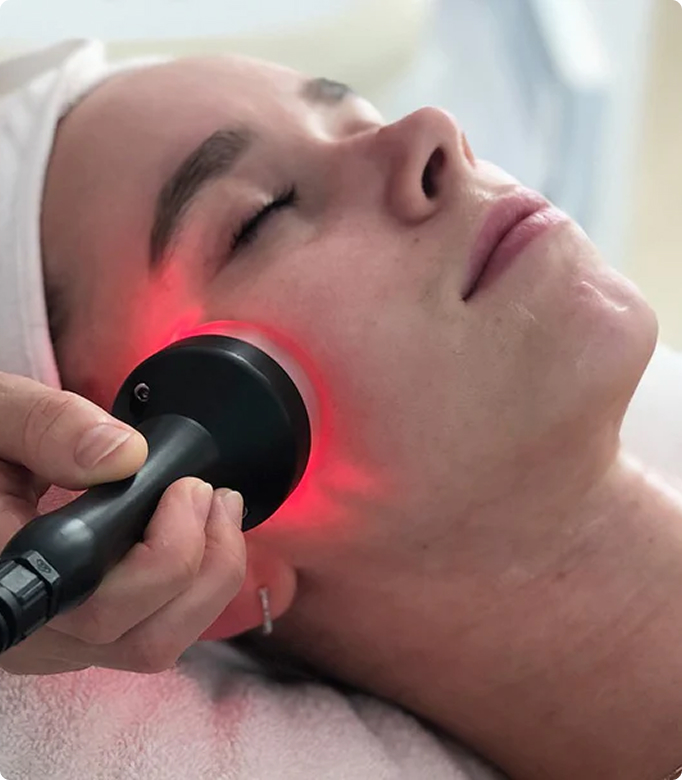 RF skin tightening treatment for facial rejuvenation and smooth skin.